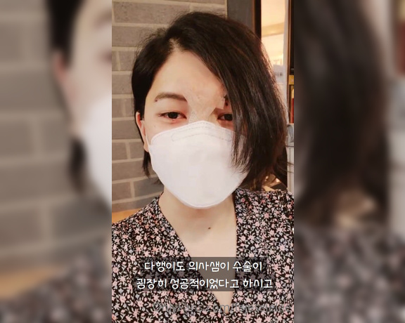 Jessie Lee aka tsjessielee - 06-01-2021 OnlyFans Video - Nose Surgery Day 1 _ 코수술 1일차 Uh still not fully awake from the anesthesia